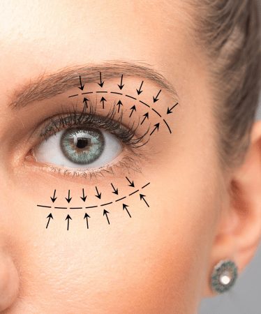 servicos-blefaroplastia-xpert